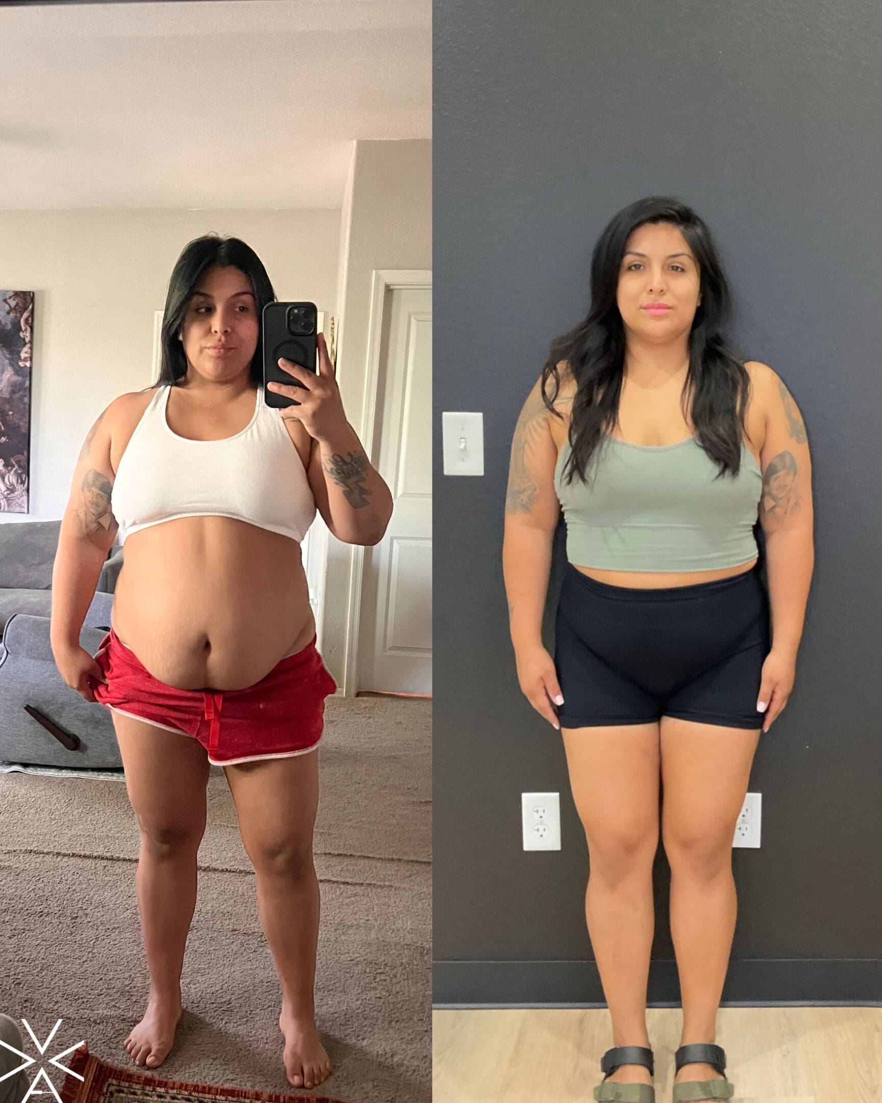 weight loss - Before & After Gallery weight loss - Before & After Gallery