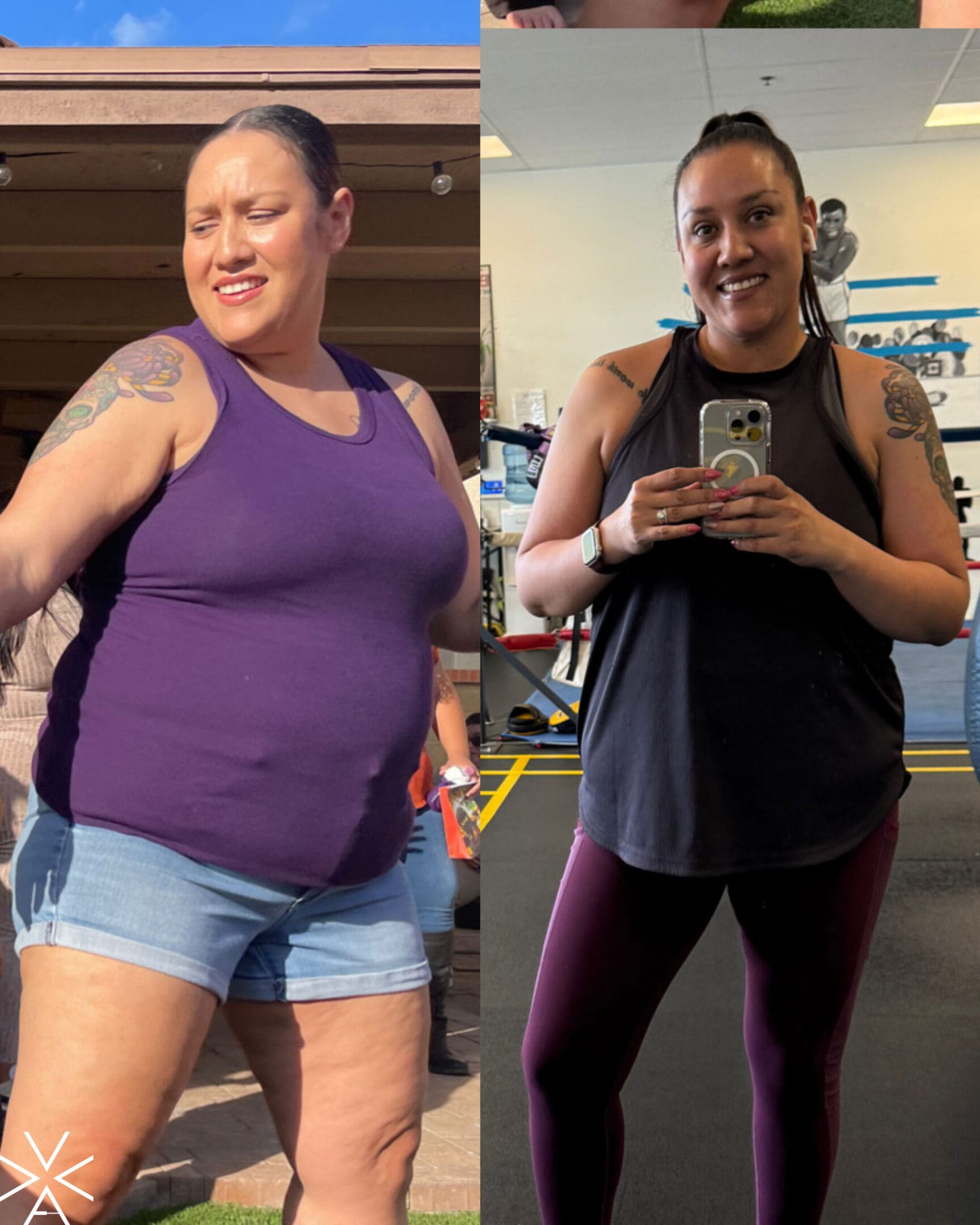 Before & After Gallery weight loss transformation Before & After Gallery weight loss transformation