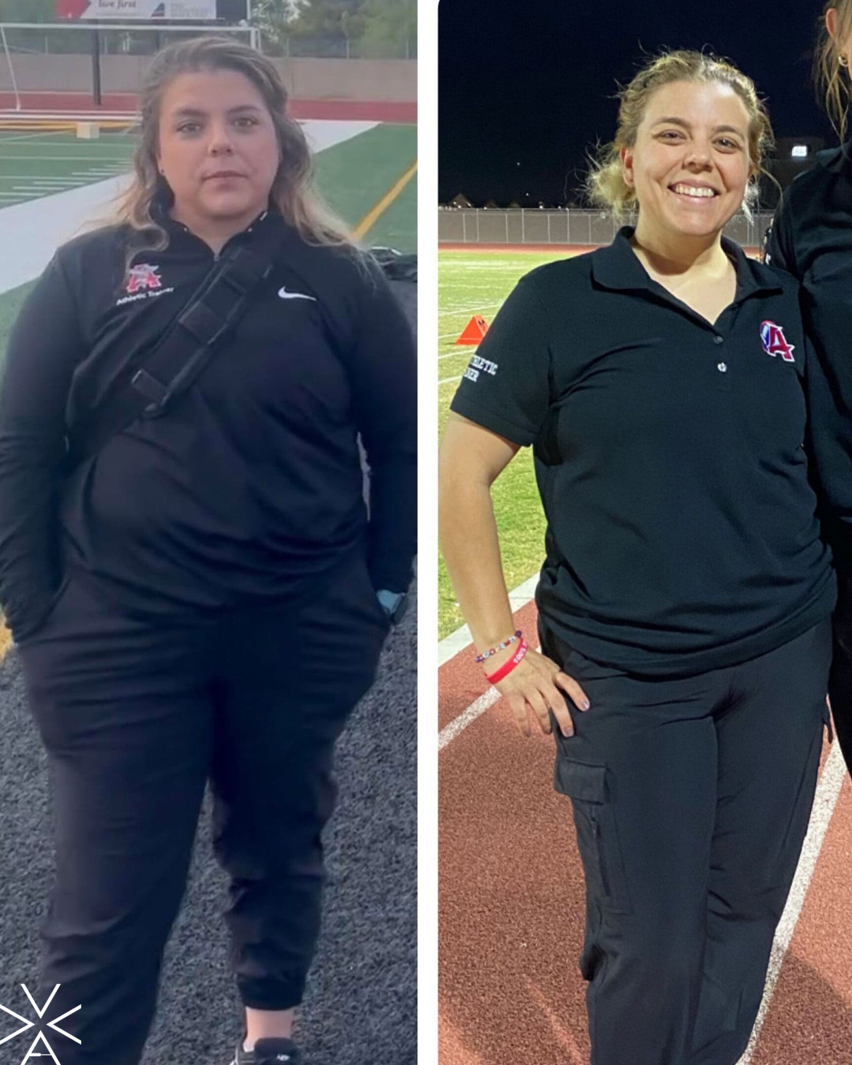 Before & After Gallery: weight loss Before & After Gallery: weight loss