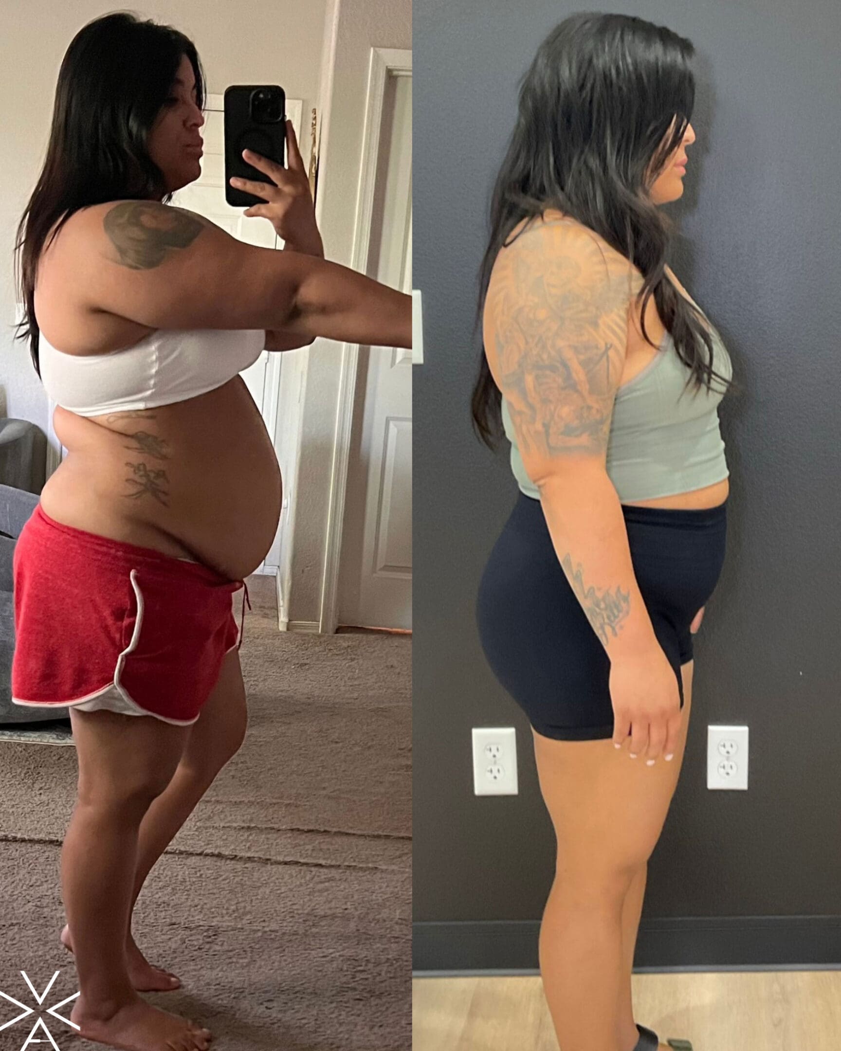 weight loss Before & After Gallery weight loss Before & After Gallery