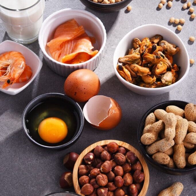 Primary Care Services: Food allergy testing